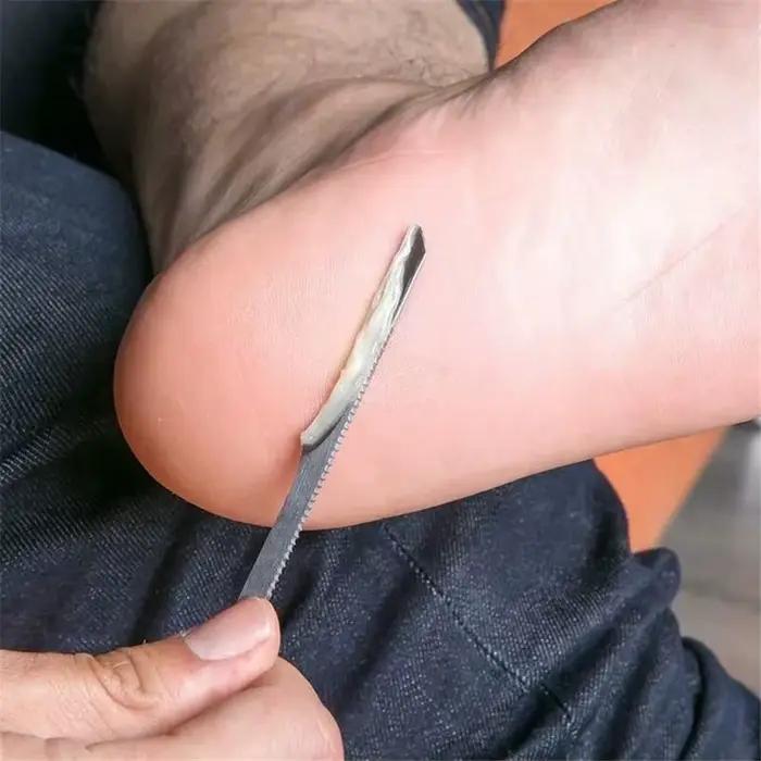 Ensemble d'outils de soins des pieds, avec tondeuse à ongles, rasoir pour les pieds, lime pour les pieds, grattoir pour peaux mortes, dissolvant de callosités, 1 pièce